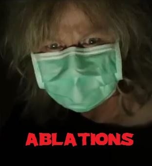 ABLATIONS | ABLATIONS | 2013