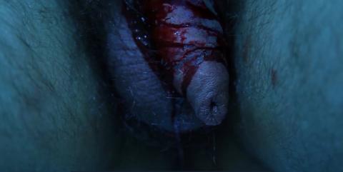 DOLL SYNDROME | DOLL SYNDROME | 2014