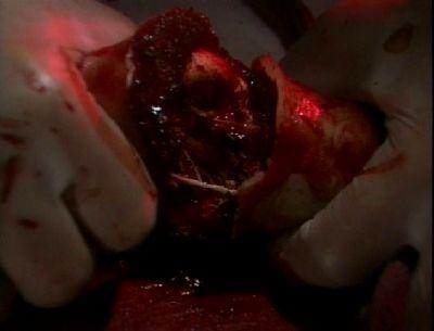 GUINEA PIG 2 | FLOWERS OF FLESH AND BLOOD / ZA GINIPIGGU 2 : CHINIKU NO HANA | 1985