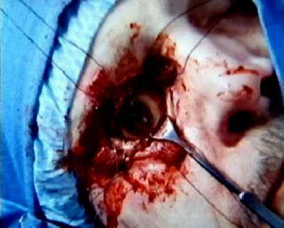 BODY BAGS | BODY BAGS | 1993