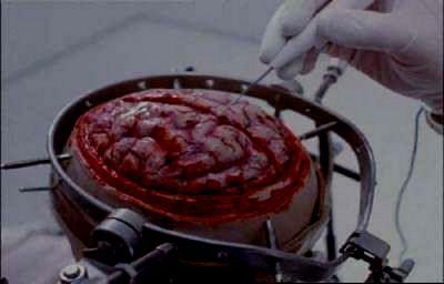 SANGLANTE PARANOIA | BRAIN DEAD | 1989