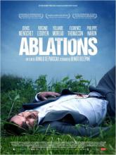 Cinema : Ablations