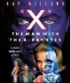 HORRIBLE CAS DU DOCTEUR X - L | X :  THE MAN WITH THE X-RAY EYES | 1963